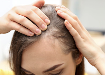 남성 탈모에 대한 효과적인 솔루션